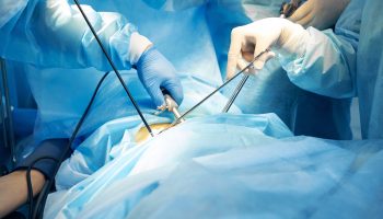 Surgical experts grasping incision with laparoscopic tools while using forceps to pick up gauze